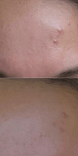 Load image into Gallery viewer, Charcoal mask before and after
