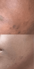Load image into Gallery viewer, Kojic Acid Brightening Serum 1oz
